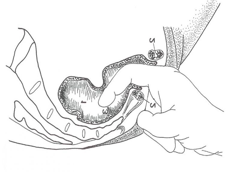 Esplorazione rettale